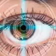 Glaucoma Laser Treatment