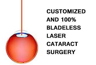 Bladeless cataract surgery singapore