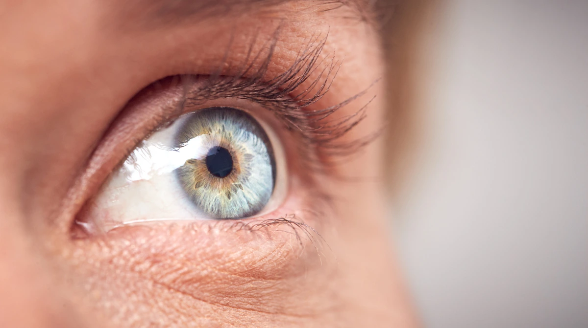cataract Surgery Lens